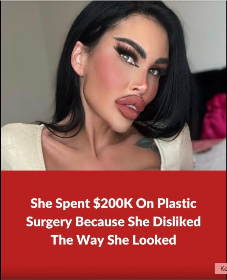 Plastic surgery addict spends $200K on plastic surgery